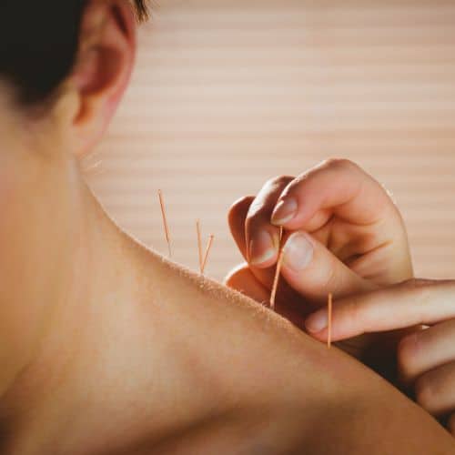 SMA FOUNDATIONAL COURSE: Trigger Point Needling for the Head, Neck and Shoulder | SPORTSMEDICINEACUPUNCTURE.COM