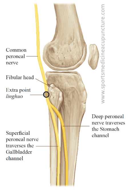 Peroneal Nerve Entrapment A Common Lower Leg Pain Generator