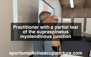 Do You have a Patient with a Supraspinatus Tear? Acupuncture as an Assessment is a Useful Method | SPORTSMEDICINEACUPUNCTURE.COM