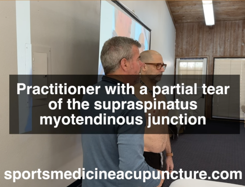 Do You have a Patient with a Supraspinatus Tear? Acupuncture as an Assessment is a Useful Method